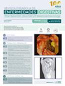 Revista Espanola De Enfermedades Digestivas投稿